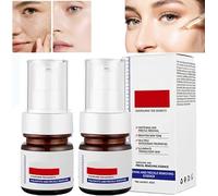 Aobenz Whitening and Freckle Removing Essence,Anti-Spot Serum,Dark Spot Correcting Serum,Anti-spot Face Serum,Spot Remover for Face,Brightening Skin and Removing Freckles (2 Pcs)