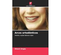 Arcos ortodônticos: História, noções básicas e tipos