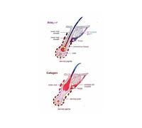 Arte de la anatomía del cabello, póster fisiología e impresión depilación, cosmetólogo, regalo, pintura en lienzo, cuadro pared, decoración habitación belleza(C,13X18 cm Unframed)