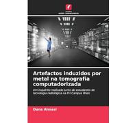 Artefactos induzidos por metal na tomografia computadorizada: Um inquérito realizado junto de estudantes de tecnologia radiológica na FH Campus Wien
