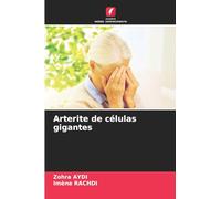 Arterite de células gigantes