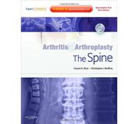 Arthritis and Arthroplasty: The Spine: Expert Consult - Online, Print and DVD, 1e 1 Har/Psc Edition by Shen MD, Francis H., Shaffrey MD, Christopher I. (2009) Hardcover
