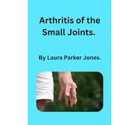 Arthritis of the Small Joints.: Understanding, Managing, and Living Well with Finger, Toe, Wrist, and Ankle Pain. (How to live with arthritis)