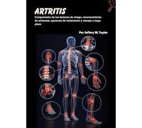 Artritis: Comprensión de los factores de riesgo, reconocimiento de síntomas, opciones de tratamiento y manejo a largo plazo