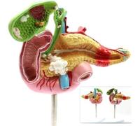 asdchZen Modelo Anatómico Patológico Humano A Escala 1:1: Páncreas, Bazo, Duodeno Y Vesícula Biliar para Formación Médica Y Tratamiento Médico Auxiliar.