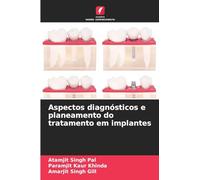 Aspectos diagnósticos e planeamento do tratamento em implantes