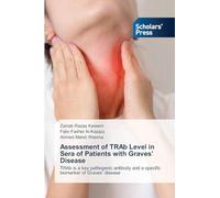 Assessment of TRAb Level in Sera of Patients with Graves' Disease
