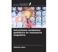 Astrocitoma cerebeloso pediátrico en resonancia magnética