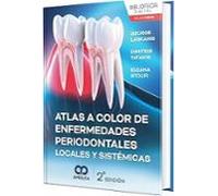 Atlas a color de enfermedades periodontales locales 2ª ed