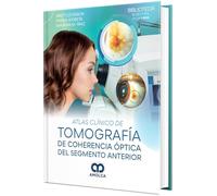 Atlas Clínico de Tomografía de Coherencia Óptica del Segmento Anterior