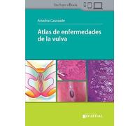 ATLAS DE ENFERMEDADES DE LA VULVA