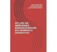 ATLAS DE IMÁGENES ENDOSCÓPICAS EN APARATO DIGESTIVO