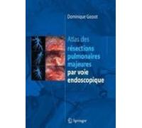 Atlas Des Résections Pulmonaires Majeures Par Voie Endoscopique (ebook