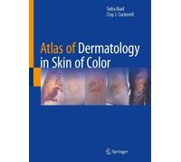 Atlas of Dermatology in Skin of Color