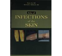 Atlas of Infections of the Skin