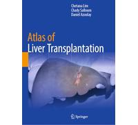 Atlas of Liver Transplantation
