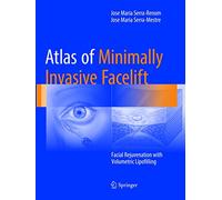 Atlas of Minimally Invasive Facelift: Facial Rejuvenation with Volumetric Lipofilling