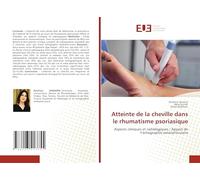 Atteinte de la cheville dans le rhumatisme psoriasique: Aspects cliniques et radiologiques / Apport de l’échographie ostéoarticulaire