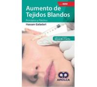 Aumento De Los Tejidos Blandos. Principios Y Práctica + E-book