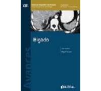 Avances En Diagnostico Por Imagenes 1: Higado