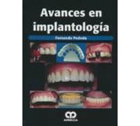 Avances En Implantologia