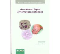 Avances en Lupus Eritematoso Sistémico