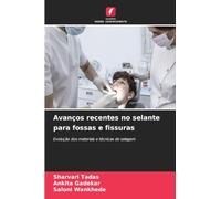 Avanços recentes no selante para fossas e fissuras: Evolução dos materiais e técnicas de selagem