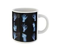 Awowee Taza de café Xray Collection X Ray of Hands con película apuntando humana, taza de té de cerámica de 325 ml, el mejor regalo o recuerdo para familiares, amigos y compañeros de trabajo