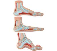 AYCDL Materiales Educativos, Modelo De Anatomía del Cuerpo Humano del Pie Humano | El Modelo De Podología Es Un Conjunto De 3 Pies Humanos | El Modelo De Pie Muestra Las Condiciones Comu