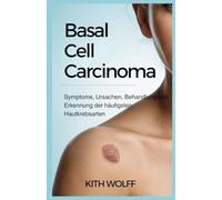 Basal Cell Carcinoma: Symptome, Ursachen, Behandlung und Erkennung der häufigsten Hautkrebsarten