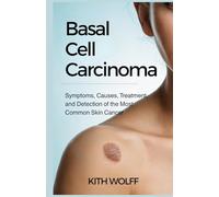 Basal Cell Carcinoma: Symptoms, Causes, Treatment, and Detection of the Most Common Skin Cancer
