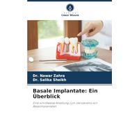 Basale Implantate: Ein Überblick: Eine schrittweise Anleitung zum Verständnis von Basalimplantaten