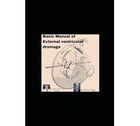 Basic Manual of External ventricular drainage: Mastering EVD: Principles, Practice, and Patient Safety