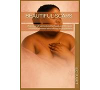 BEAUTIFUL SCARS: A memoir of survival,motherhood, and the quiet rebirth of a woman who refused to stay broken