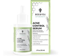 BEE and YOU Tratamiento del acné con ácido salicílico, veneno de abeja y extracto de propóleos 100% natural, suero para el acné para cara y cuerpo para controlar y eliminar los brotes | 1 onza