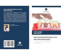 BELASTUNGSPROTOKOLLE IN DER IMPLANTOLOGIE: Ein umfassender Überblick über Strategien zur Implantatbelastung