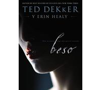 Beso: Ella te roba más que el corazón