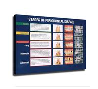 BIANMTSW Póster de anatomía de dientes y salud bucal, gráfico educativo detallado para clínica dental, decoración de oficina de educación del paciente, sin marco, 40 x 60 cm