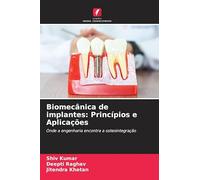 Biomecânica de implantes: Princípios e Aplicações