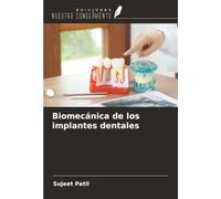 Biomecánica de los implantes dentales