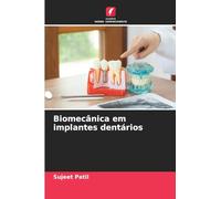 Biomecânica em implantes dentários