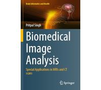 Biomedical Image Analysis: Special Applications in MRIs and CT scans (Brain Informatics and Health)