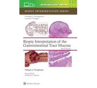 Biopsy Interpretation of the Gastrointestinal Tract Mucosa Volume 2: Neoplastic: Print + eBook with Multimedia (Biopsy Interpretation Series)