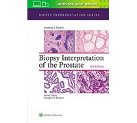 Biopsy Interpretation of the Prostate (Biopsy Interpretation Series)