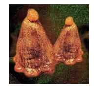 Black to Comm - Oocyte Oil & Stolen Androg (Vinyl Green) [Vinilo]