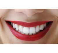 Blanqueamiento dental con revisión radiografía periapical y limpieza