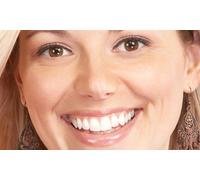Blanqueamiento LED limpieza dental con ultrasonidos pulido revisión y radiografía digital