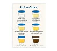 Body Hydration Status Chart Educational Canvas Print for Bathroom Office Wellness Clinic Decor(Framed,08x12inch(20x30cm))