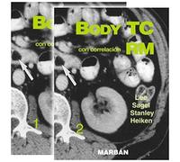 Body TC con correlación RM