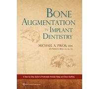 Bone Augmentation in Implant Dentistry: A Step-By-Step Guide to Predictable Alveolar Ridge and Sinus Grafting